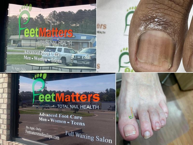 FeetMatters MediNail Spa
