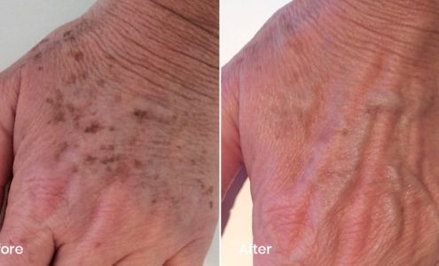 royce plastic surgery