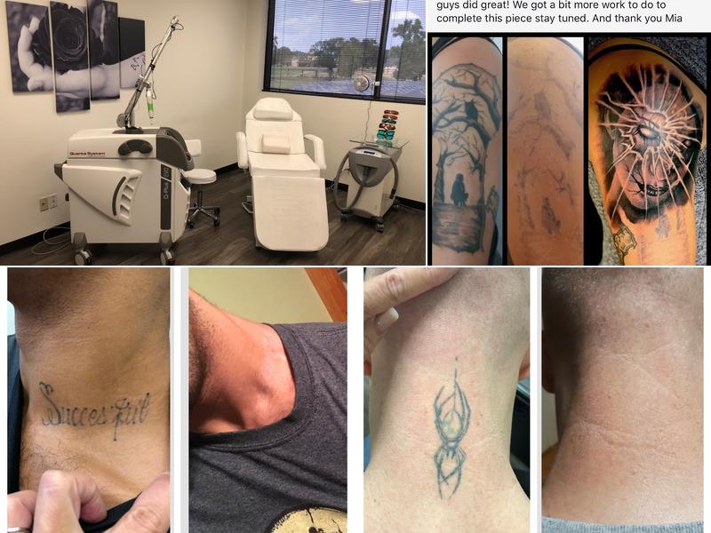 Vanish Laser Aesthetics