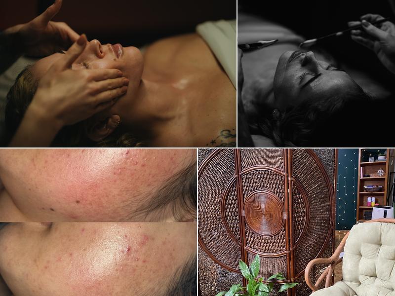 Esthetic Remedy with Kari