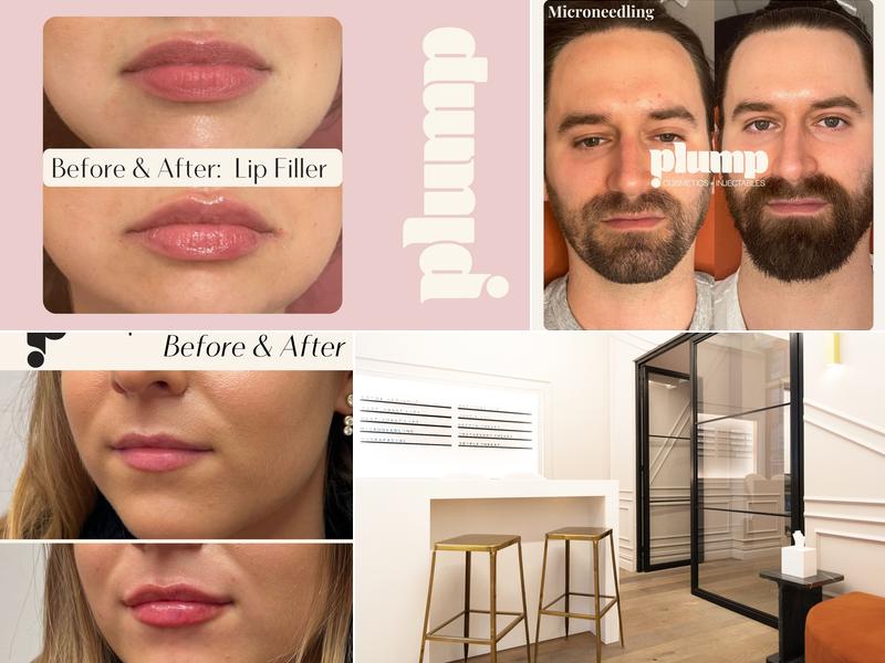 Plump Cosmetics & Injectables