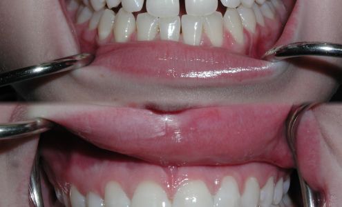 Robert L Crosby, DMD, PC 100 N Pine St, Greenville Alabama 36037