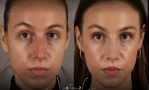 Jonathan Cabin, MD - Facial Plastic Surgeon @ SkinDC