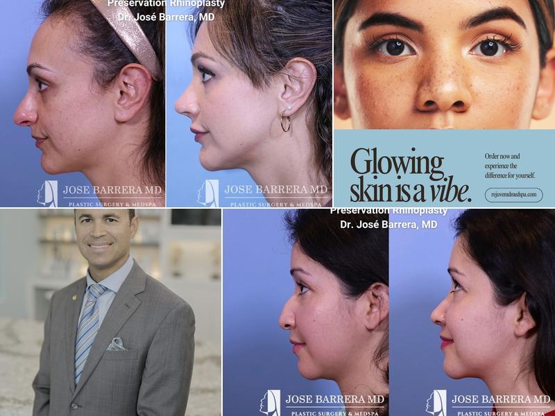 Jose Barrera, MD, Facial Plastic and Reconstructive Surgeon