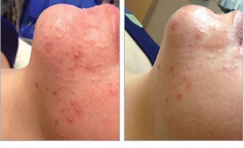 Optimal Skin & Laser Center