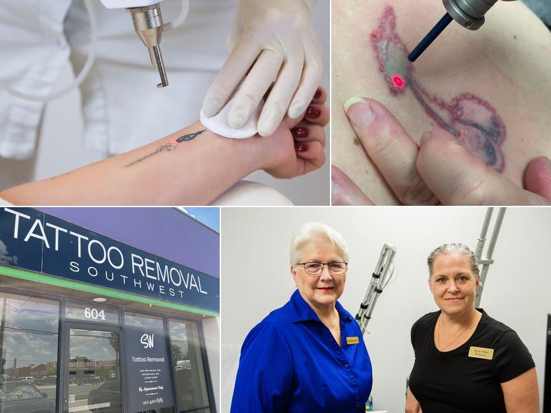 South West Tattoo Removal Program