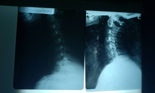 Kootenai Clinic Internal Medicine - Coeur d'Alene