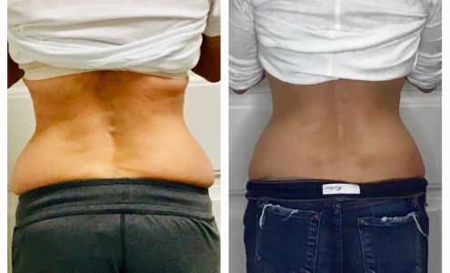 Cryo You (Spearfish)