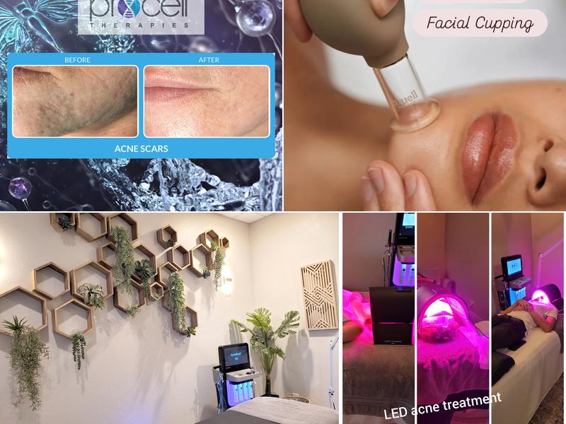 Glo Aesthetics and Hydration