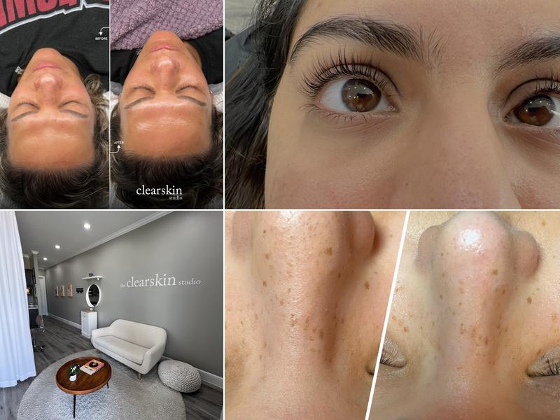 The Clearskin Studio