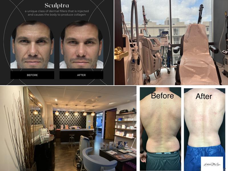 Aesthetica Med Spa of San Diego