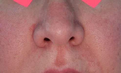 Richard A. Cirelli, MD, PC 955 Black Dr A, Prescott Arizona 86305