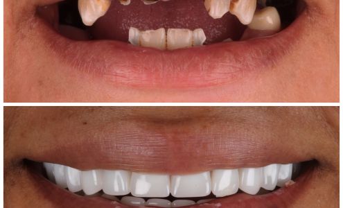 Austin Artistic Dental