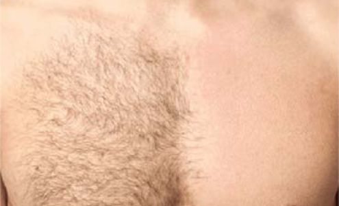 Linda's Sugar Hair Removal