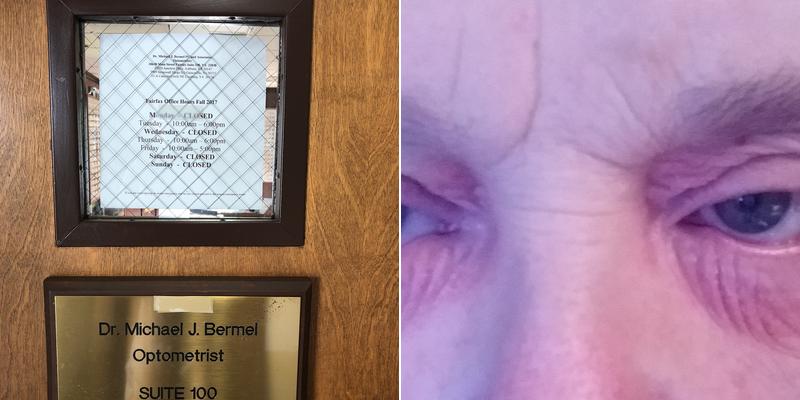 Michael J. Bermel, OD