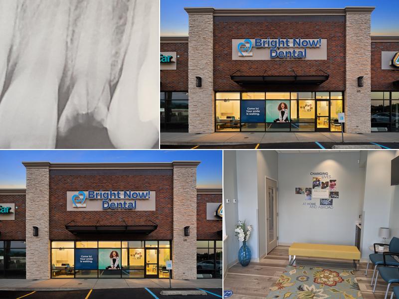 Bright Now! Dental & Implants - Spokane Valley