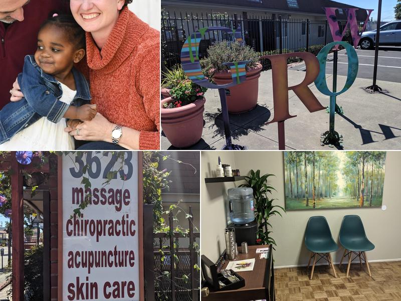 Acupuncture by Devon