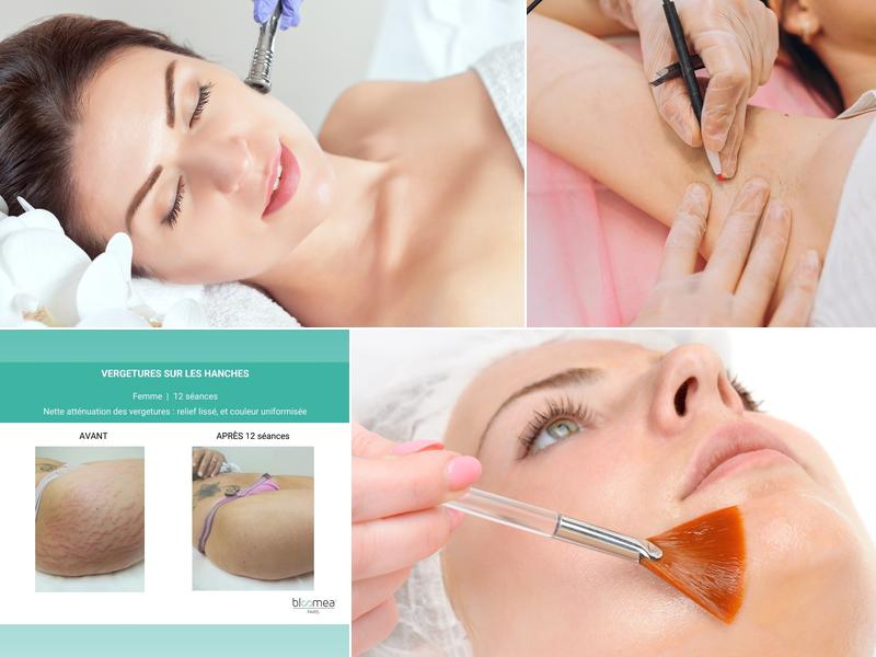 Centre esthétique Re'SourceBeauté