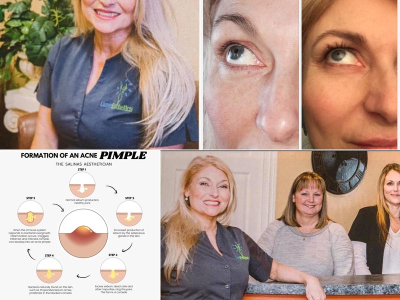 Laser Esthetics Botox & Medi Spa