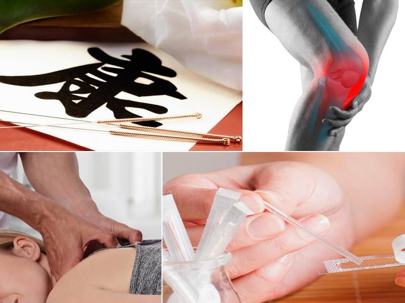 Acupuncture Guillaume Levesque