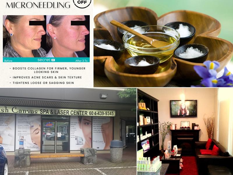 Fresh Canvas Spa And Laser Centre