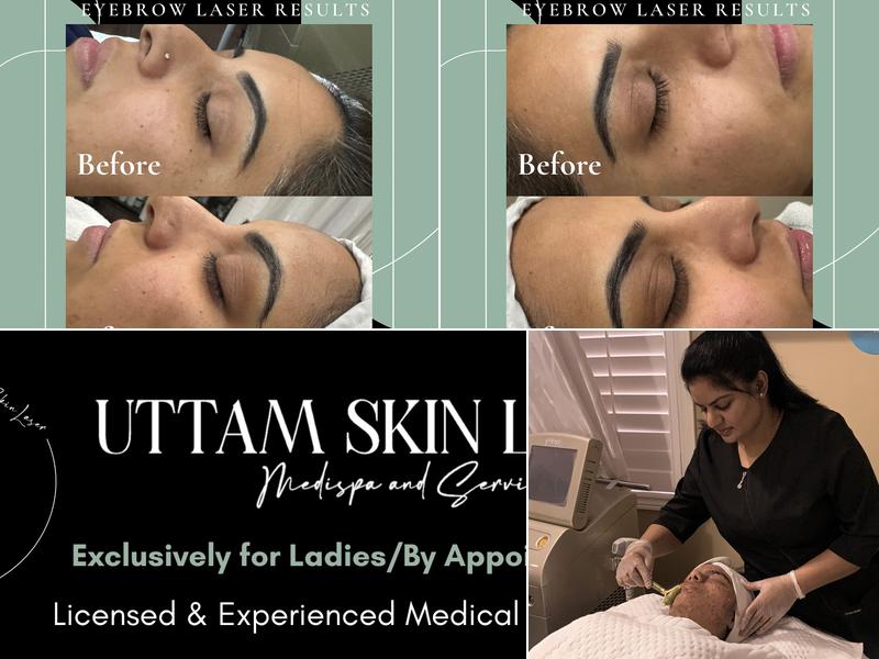 Uttam Skin Laser Brampton Medical Spa