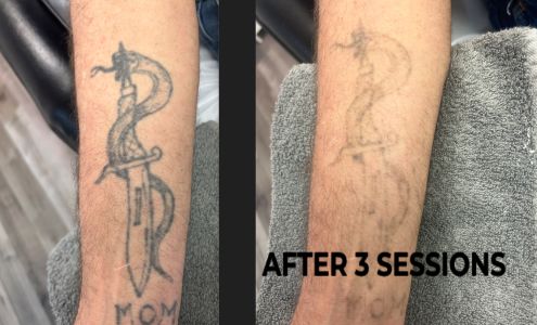 Brantford Laser Clinic