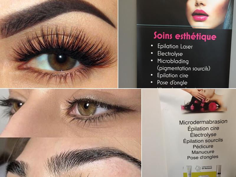 Esthetique Sainte-Thérèse Epilation au Laser Julie Levasseur