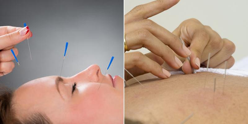 Clinique d'Acupuncture Danielle Chapdelaine Sorel-Tracy