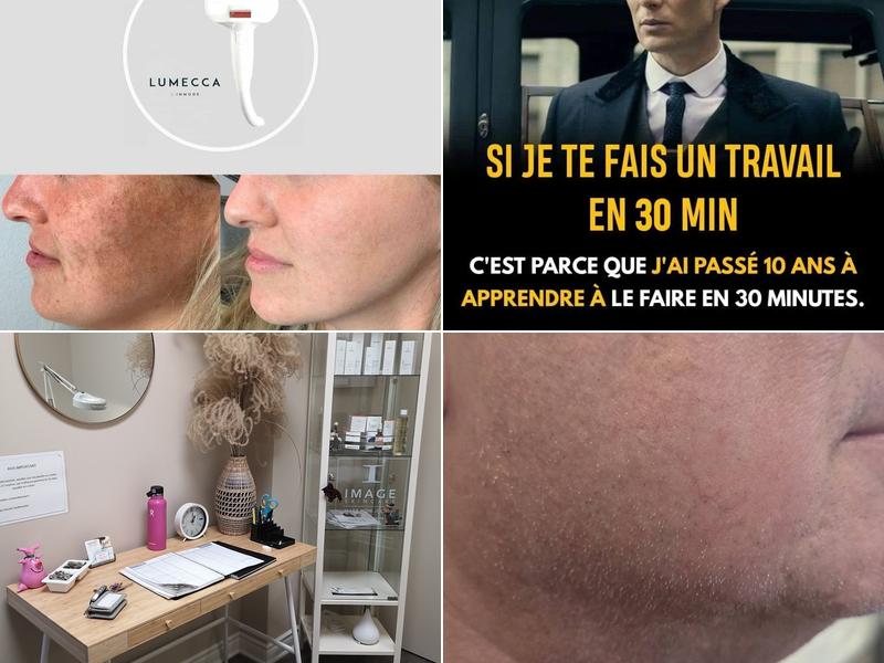 Esthétique et électrolyse Carolle Guillemette