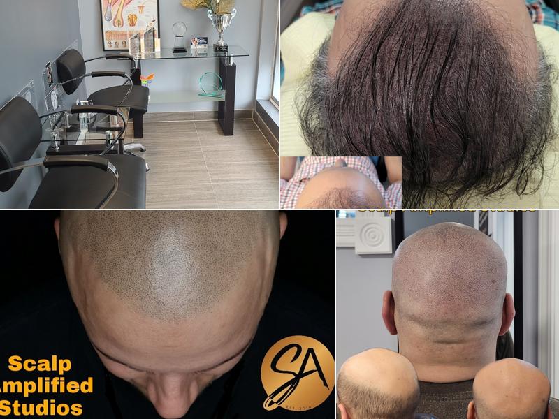 Scalp Amplified Studios