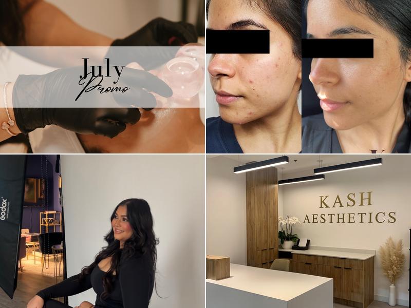 Kash Aesthetics & Medical Spa