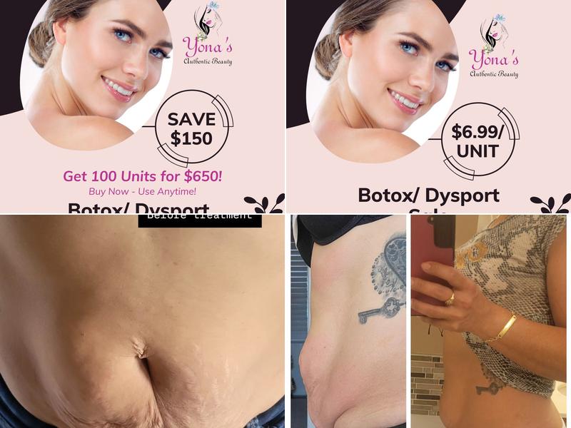 Yonas Authentic Beauty