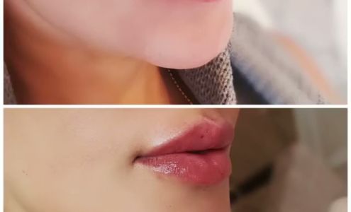 Prima Beauty Aesthetics | Cosmetology center Ottawa