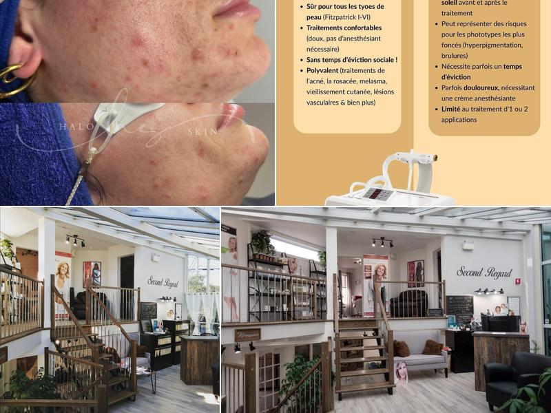 Centre de Santé Second Regard