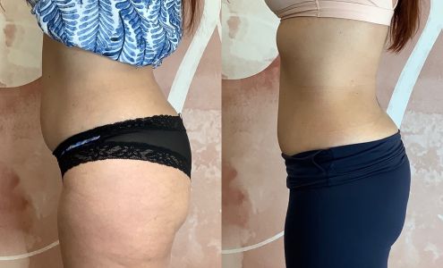 Her Body Bar Body Sculpting Studio