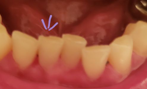 Stacey Family Dental