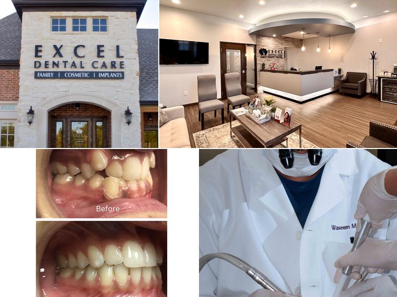 Excel Dental Care