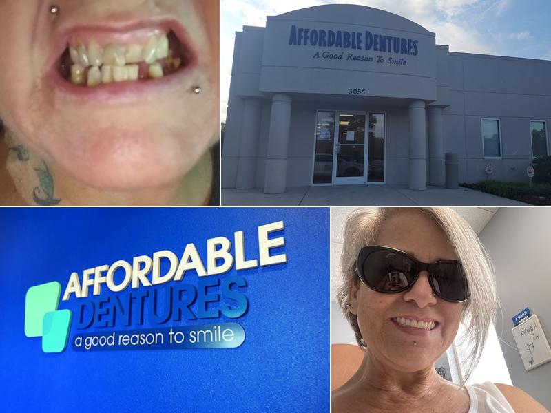Affordable Dentures & Implants