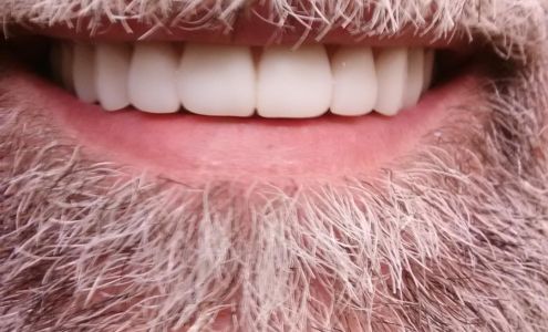 Affordable Dentures & Implants