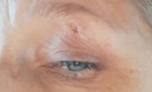 Marlene Wright (dermatologist)