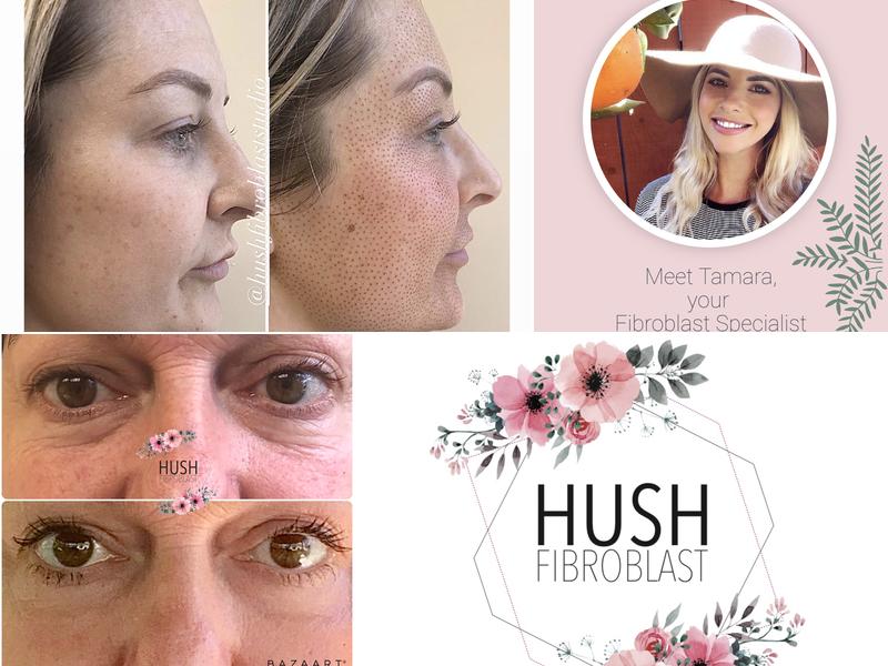 Hush Fibroblast Studio