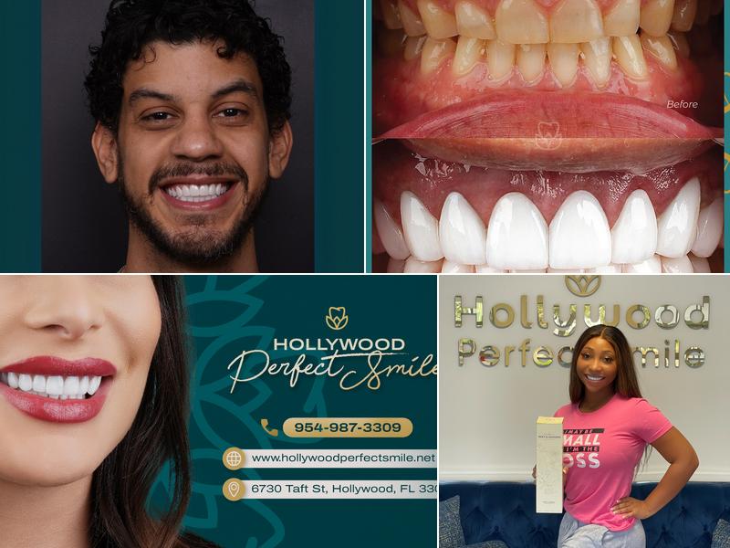 Hollywood Perfect Smile