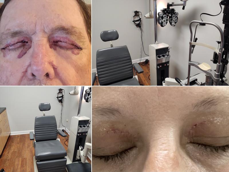 Dr. Donna Corder, MD - Southern Eye Group