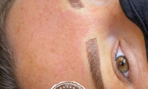 Aesthetics and microblading