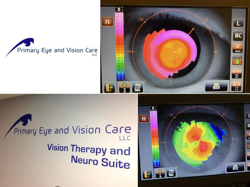 Primary Eye and Vision Care, PC