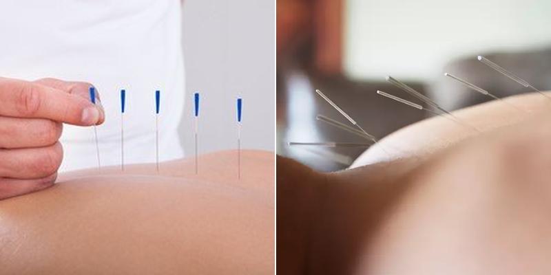 Oriental Day Acupuncture