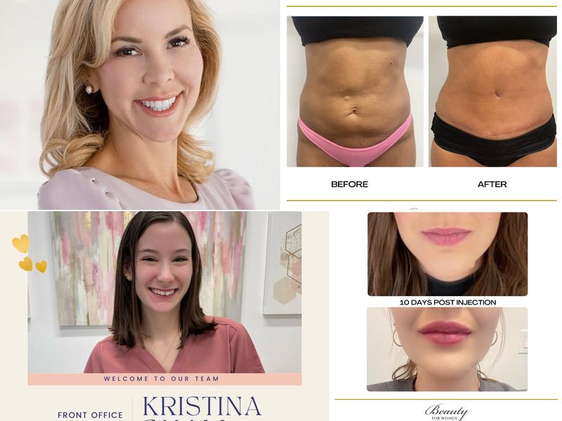 Angela Champion, M.D. - Plastic Surgeon