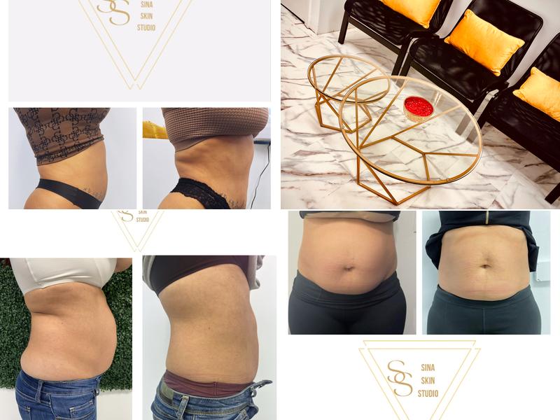 Sina Skin Studio