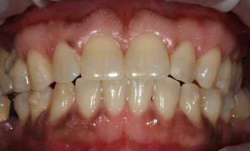 Dr. Gary L. Henkel, DDS 301 Horsham Rd # G, Horsham Pennsylvania 19044